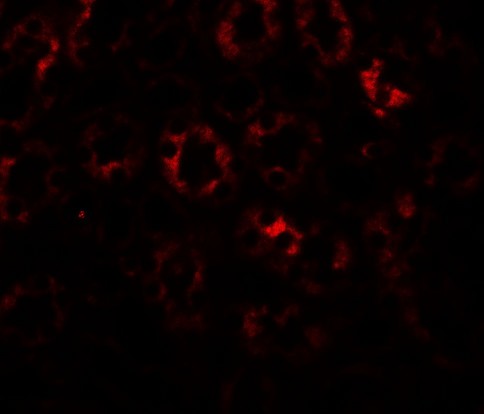 SLC1A7 / EAAT5 Antibody - Immunofluorescence of SLC1A7 in mouse kidney tissue with SLC1A7 antibody at 20 ug/ml.