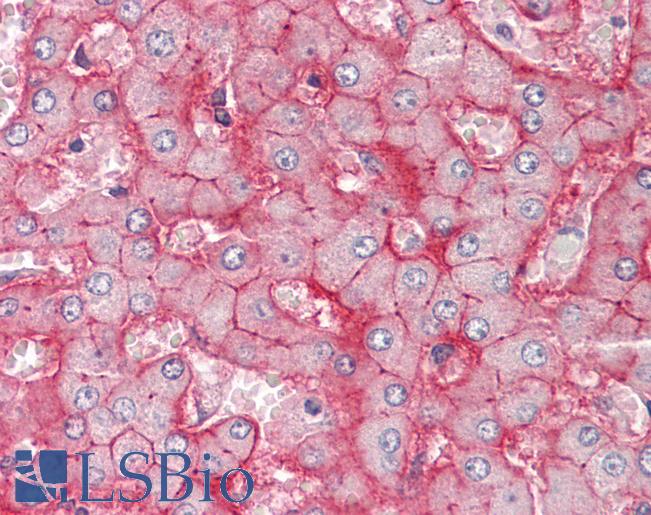 SLC22A1 Antibody - Anti-SLC22A1 / OCT1 antibody IHC staining of human liver. Immunohistochemistry of formalin-fixed, paraffin-embedded tissue after heat-induced antigen retrieval.