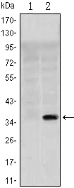 SLC22A1 Antibody - Western blot using SLC22A1 monoclonal antibody against HEK293 (1) and SLC22A1(AA: 284-347)-hIgGFc transfected HEK293 (2) cell lysate.