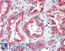 SLC22A1 Antibody - Human Kidney: Formalin-Fixed, Paraffin-Embedded (FFPE)