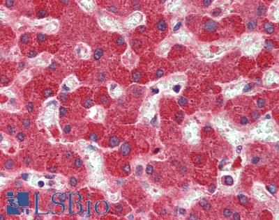 SLC22A1 Antibody - Human Liver: Formalin-Fixed, Paraffin-Embedded (FFPE)
