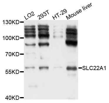 SLC22A1 Antibody - Western blot analysis of extracts of various cell lines, using SLC22A1 antibody at 1:1000 dilution. The secondary antibody used was an HRP Goat Anti-Rabbit IgG (H+L) at 1:10000 dilution. Lysates were loaded 25ug per lane and 3% nonfat dry milk in TBST was used for blocking. An ECL Kit was used for detection and the exposure time was 5s.