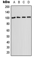 SLC22A2 Antibody - Western blot analysis of  SLC22A2 expression in A431 (A); HepG2 (B); SP2/0 (C); H9C2 (D) whole cell lysates.