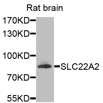 SLC22A2 Antibody - Western blot analysis of extracts of rat brain cells.