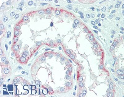 SLC22A2 Antibody - Human Kidney: Formalin-Fixed, Paraffin-Embedded (FFPE)