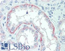 SLC22A2 Antibody - Human Kidney: Formalin-Fixed, Paraffin-Embedded (FFPE)