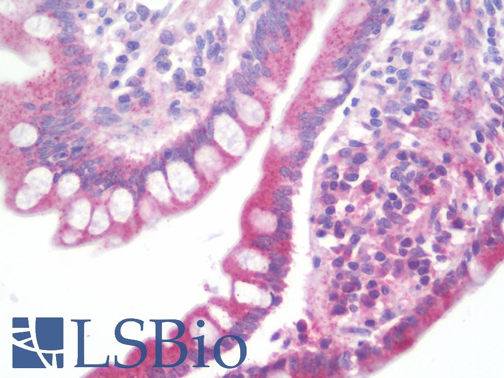 SLC22A4 / OCTN1 Antibody - Anti-SLC22A4 / OCTN1 antibody IHC staining of human small intestine. Immunohistochemistry of formalin-fixed, paraffin-embedded tissue after heat-induced antigen retrieval.