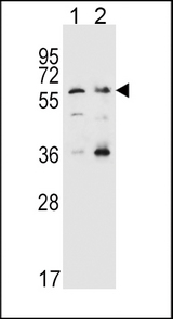 SLC22A4 / OCTN1 Antibody - SLC22A4 Antibody western blot of HeLa(lane 1),K562(lane 2) cell line lysates (35 ug/lane). The SLC22A4 antibody detected the SLC22A4 protein (arrow).