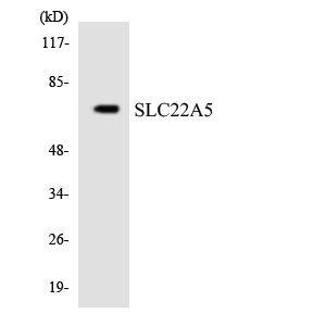 SLC22A5 / OCTN2 Antibody - Western blot analysis of the lysates from HeLa cells using SLC22A5 antibody.