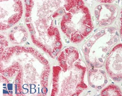 SLC22A5 / OCTN2 Antibody - Human Kidney: Formalin-Fixed, Paraffin-Embedded (FFPE)