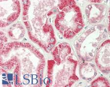 SLC22A5 / OCTN2 Antibody - Human Kidney: Formalin-Fixed, Paraffin-Embedded (FFPE)