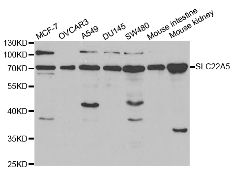 SLC22A5 / OCTN2 Antibody - Western blot analysis of extracts of various cell lines, using SLC22A5 antibody at 1:1000 dilution. The secondary antibody used was an HRP Goat Anti-Rabbit IgG (H+L) at 1:10000 dilution. Lysates were loaded 25ug per lane and 3% nonfat dry milk in TBST was used for blocking.