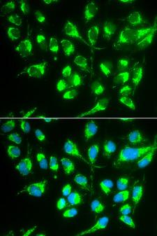 SLC22A5 / OCTN2 Antibody - Immunofluorescence analysis of MCF-7 cells using SLC22A5 antibody. Blue: DAPI for nuclear staining.