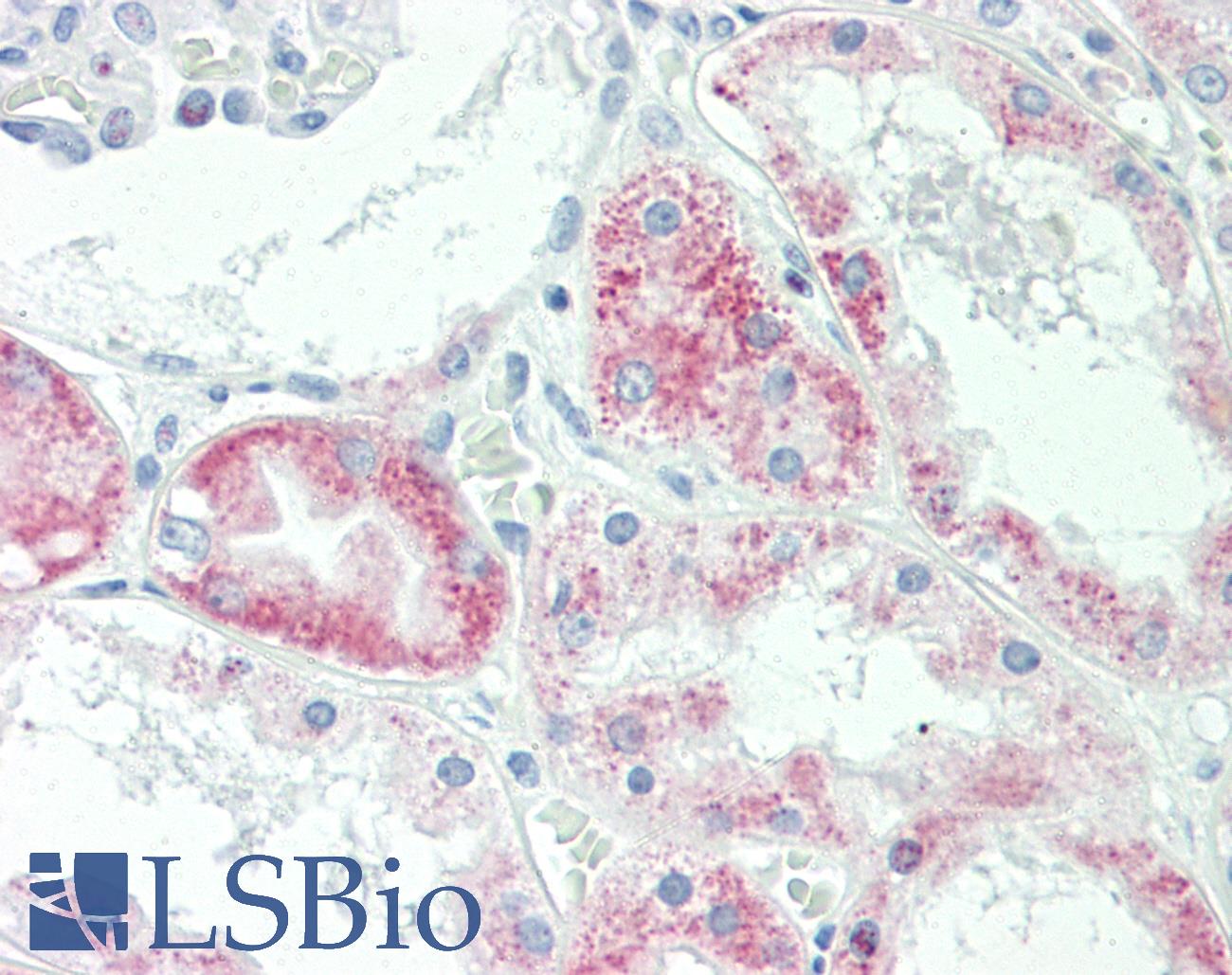 SLC22A6 / OAT1 Antibody - Anti-SLC22A6 / OAT1 antibody IHC staining of human kidney. Immunohistochemistry of formalin-fixed, paraffin-embedded tissue after heat-induced antigen retrieval. Antibody dilution 1:50.