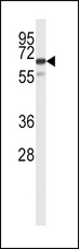 SLC22A6 / OAT1 Antibody - Western blot of SLC22A6 Antibody in CEM cell line lysates (35 ug/lane). SLC22A6 (arrow) was detected using the purified antibody.