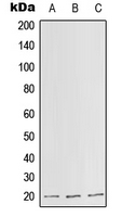 SLC25A11 Antibody - Western blot analysis of SLC25A11 expression in HepG2 (A); Raw264.7 (B); H9C2 (C) whole cell lysates.