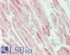 SLC25A11 Antibody - Human Heart: Formalin-Fixed, Paraffin-Embedded (FFPE)