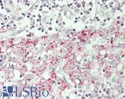 SLC25A11 Antibody - Human Thymus: Formalin-Fixed, Paraffin-Embedded (FFPE)