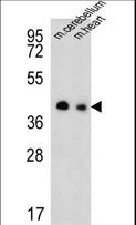 SLC25A19 Antibody - Western blot of SLC25A19 Antibody in mouse cerebellum,heart tissue lysates (35 ug/lane). SLC25A19 (arrow) was detected using the purified antibody.