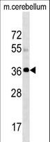 SLC25A20 / CACT Antibody - SLC25A20 Antibody western blot of mouse cerebellum tissue lysates (35 ug/lane). The SLC25A20 antibody detected the SLC25A20 protein (arrow).
