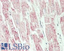 SLC25A20 / CACT Antibody - Human Heart: Formalin-Fixed, Paraffin-Embedded (FFPE)