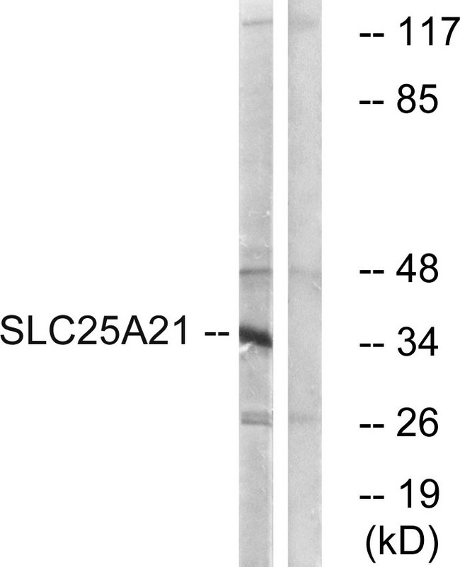 SLC25A21 / ODC1 Antibody - Western blot analysis of lysates from HepG2 cells, using SLC25A21 Antibody. The lane on the right is blocked with the synthesized peptide.