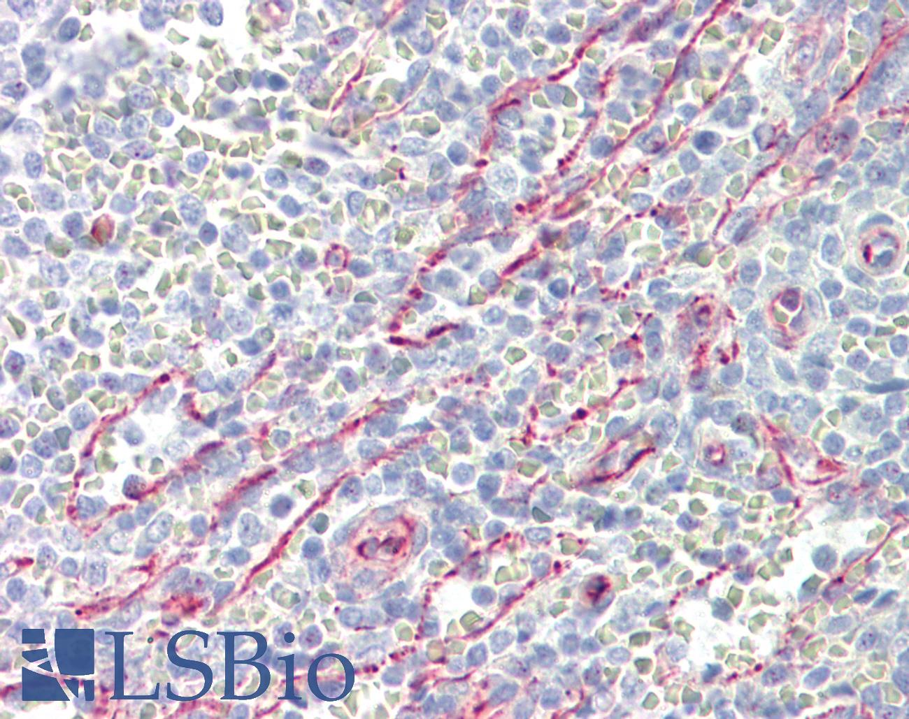 SLC25A21 / ODC1 Antibody - Anti-SLC25A21 / ODC antibody IHC of human spleen. Immunohistochemistry of formalin-fixed, paraffin-embedded tissue after heat-induced antigen retrieval. Antibody dilution 5 ug/ml.
