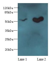 SLC25A25 Antibody - Western blot. All lanes: SLC25A25 antibody at 10 ug/ml. Lane 1: Mouse liver tissue. Lane 2: Mouse brain tissue. Secondary Goat polyclonal to Rabbit IgG at 1:10000 dilution. Predicted band size: 53 kDa. Observed band size: 53 kDa.