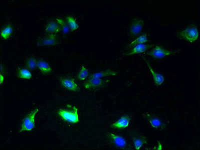 SLC25A25 Antibody - Immunofluorescent analysis of U251 cells using SLC25A25 Antibody at dilution of 1:100 and Alexa Fluor 488-congugated AffiniPure Goat Anti-Rabbit IgG(H+L)