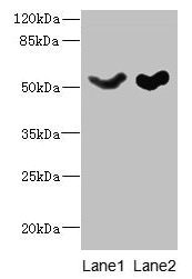 SLC25A25 Antibody - Western blot All lanes: SLC25A25 antibody at 10µg/ml Lane 1: Mouse liver tissue Lane 2: Mouse brain tissue Secondary Goat polyclonal to rabbit IgG at 1/10000 dilution Predicted band size: 53, 56, 57, 55, 41 kDa Observed band size: 53 kDa