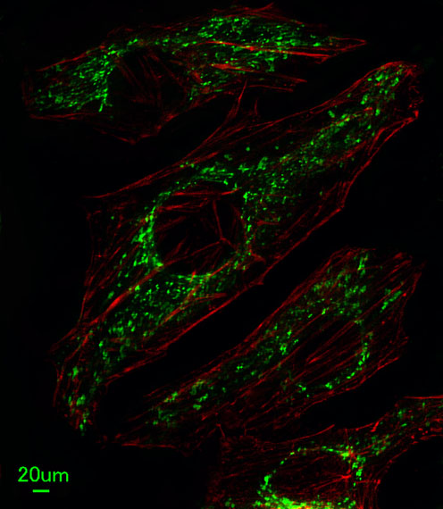 SLC25A37 / Mitoferrin Antibody - Immunofluorescence of HeLa cells, using SLC25A37 Antibody. Antibody was diluted at 1:25 dilution. Alexa Fluor 488-conjugated goat anti-rabbit lgG at 1:400 dilution was used as the secondary antibody (green). Cytoplasmic actin was counterstained with Dylight Fluor 554 (red) conjugated Phalloidin (red).