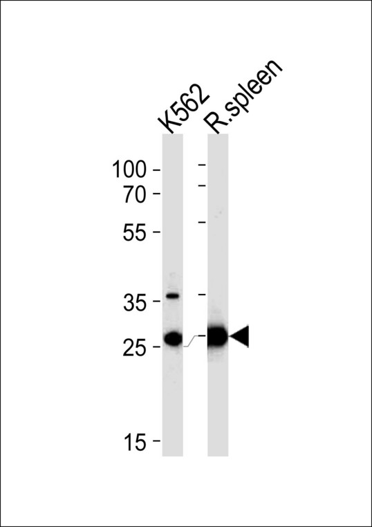 SLC25A37 / Mitoferrin Antibody - SLC25A37 Antibody western blot of K562 cell line and rat spleen tissue lysates (35 ug/lane). The SLC25A37 antibody detected the SLC25A37 protein (arrow).