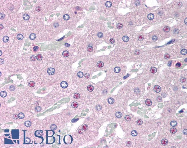 SLC25A47 / C14orf68 Antibody - Anti-SLC25A47 / C14orf68 antibody IHC of human liver. Immunohistochemistry of formalin-fixed, paraffin-embedded tissue after heat-induced antigen retrieval. Antibody concentration 5 ug/ml.