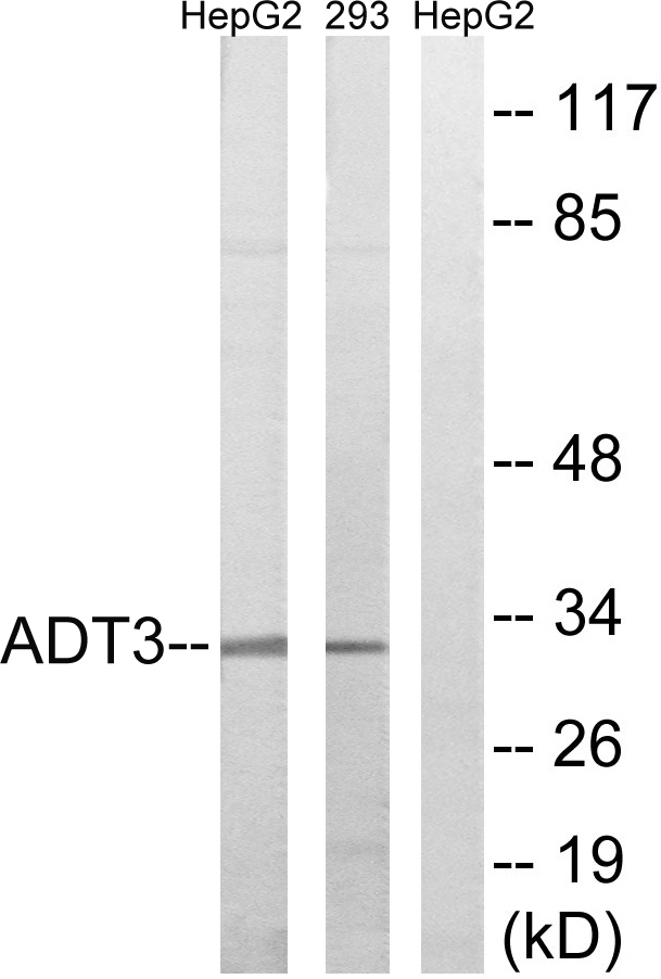 SLC25A6 / ANT3 Antibody - Western blot analysis of lysates from HepG2 and 293 cells, using SLC25A6 Antibody. The lane on the right is blocked with the synthesized peptide.