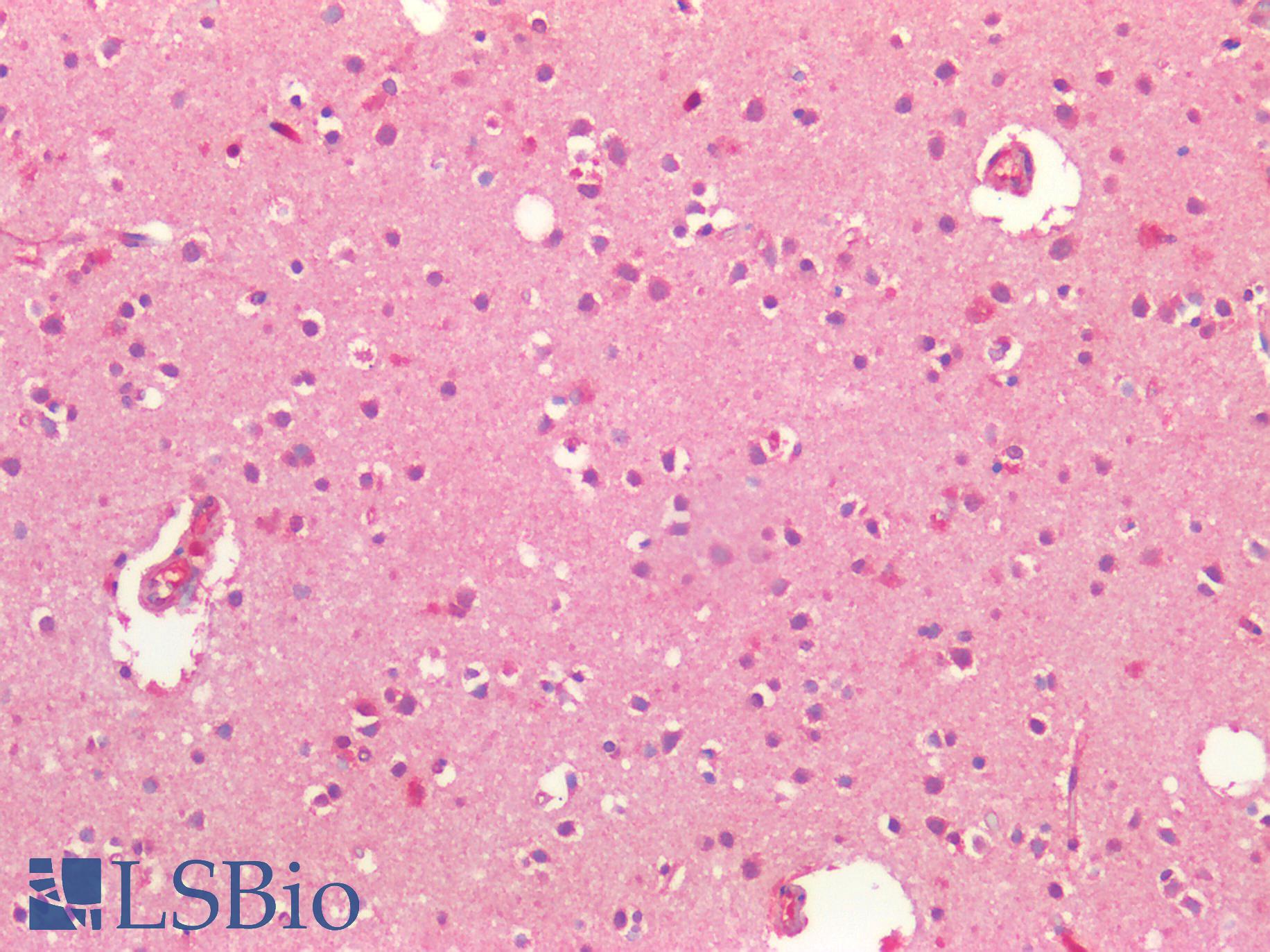 SLC27A1 / FATP Antibody - Human Brain, Cortex: Formalin-Fixed, Paraffin-Embedded (FFPE)