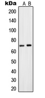 SLC28A2 Antibody - Western blot analysis of CNT2 expression in A549 (A); HepG2 (B) whole cell lysates.