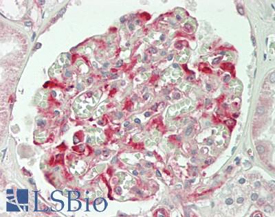SLC28A2 Antibody - Human Kidney: Formalin-Fixed, Paraffin-Embedded (FFPE)
