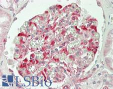 SLC28A2 Antibody - Human Kidney: Formalin-Fixed, Paraffin-Embedded (FFPE)