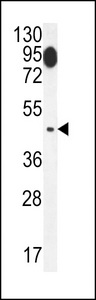 SLC29A1 / ENT1 Antibody - ENT1(Slc29a1) western blot of mouse brain tissue lysates (35 ug/lane). The ENT1 antibody detected ENT1 protein (arrow).