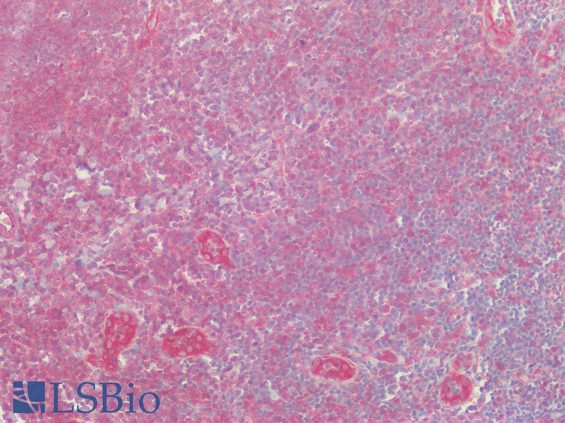 SLC29A1 / ENT1 Antibody - Human Tonsil: Formalin-Fixed, Paraffin-Embedded (FFPE)