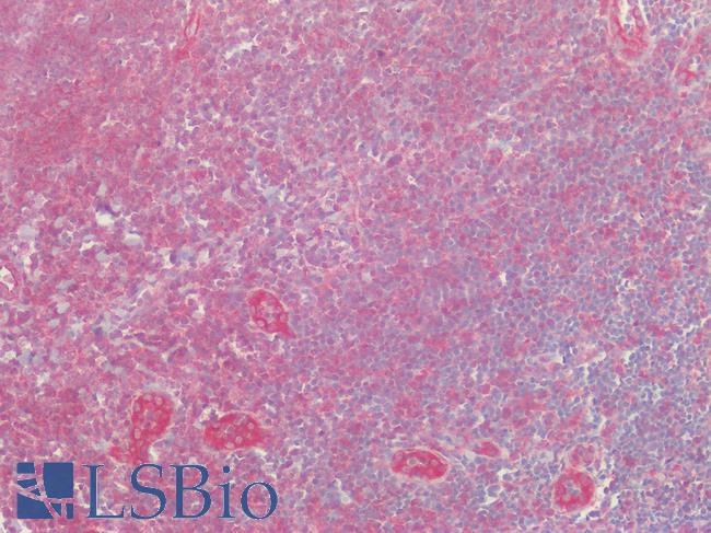 SLC29A1 / ENT1 Antibody - Human Tonsil: Formalin-Fixed, Paraffin-Embedded (FFPE)