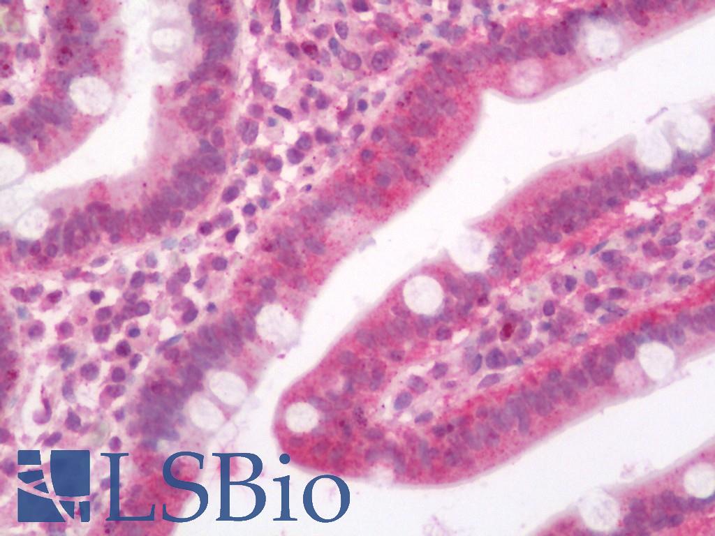 SLC29A1 / ENT1 Antibody - Human Small Intestine: Formalin-Fixed, Paraffin-Embedded (FFPE)
