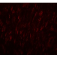 SLC29A1 / ENT1 Antibody - Immunofluorescence of SLC29A1 in human ovary tissue with SLC29A1 antibody at 20 µg/mL.