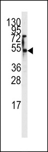 SLC29A1 / ENT1 Antibody - Western blot of anti-ENT1(Slc29a1) Antibody (S254) in 293 cell line lysates (35 ug/lane). ENT1 (arrow) was detected using the purified antibody.