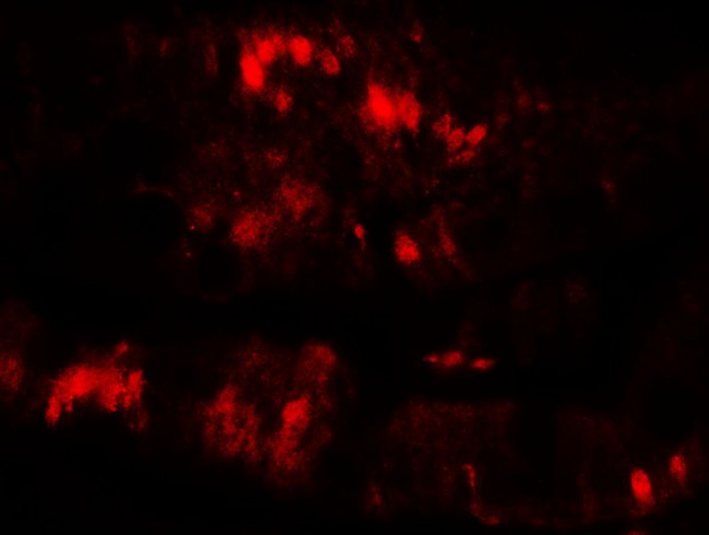SLC29A3 / ENT3 Antibody - Immunofluorescence of SLC29A3 in rat colon muscle tissue with SLC29A3 antibody at 20 ug/mL.