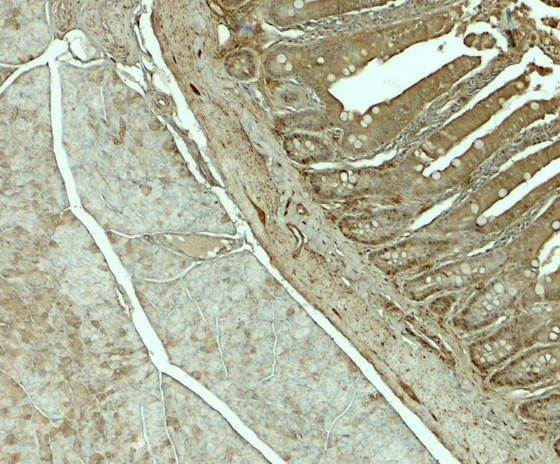 SLC29A3 / ENT3 Antibody - Immunohistochemistry of SLC29A3 in rat colon tissue with SLC29A3 antibody at 5 ug/mL.