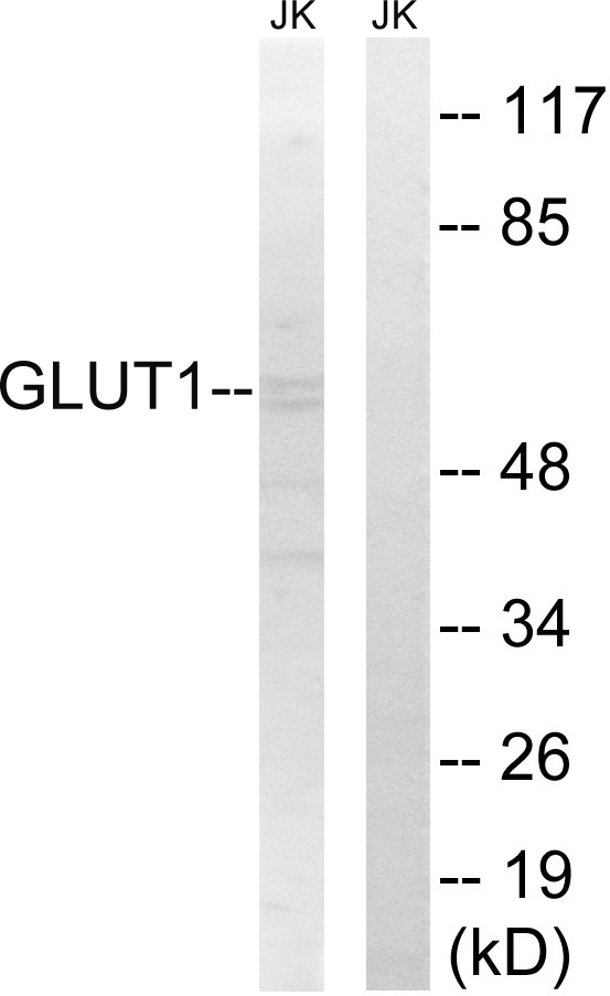 SLC2A1 / GLUT-1 Antibody - Western blot analysis of lysates from Jurkat cells, using GLUT1 Antibody. The lane on the right is blocked with the synthesized peptide.