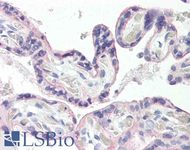 SLC2A1 / GLUT-1 Antibody - Anti-SLC2A1 / GLUT1 antibody IHC of human placenta. Immunohistochemistry of formalin-fixed, paraffin-embedded tissue after heat-induced antigen retrieval. Antibody dilution 5 ug/ml.