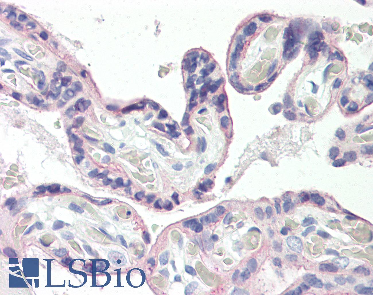SLC2A1 / GLUT-1 Antibody - Anti-SLC2A1 / GLUT1 antibody IHC of human placenta. Immunohistochemistry of formalin-fixed, paraffin-embedded tissue after heat-induced antigen retrieval. Antibody dilution 5 ug/ml.