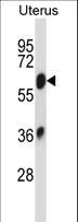 SLC2A13 / HMIT / GLUT13 Antibody - SLC2A13 Antibody western blot of human normal Uterus tissue lysates (35 ug/lane). The SLC2A13 antibody detected the SLC2A13 protein (arrow).